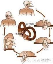 耳石症自我复位视频,跟随视频轻松缓解眩晕