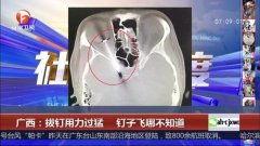 飞钉视频,揭秘现代建筑中的创新连接技术