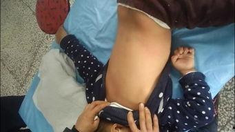 挟痧视频,传统养生新视角