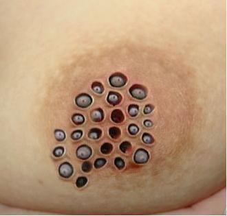 超级恶心拔寄生虫视频,揭秘超级恶心拔寄生虫视频背后的惊人真相