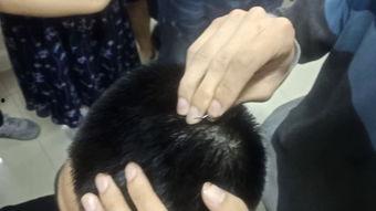 头皮针视频教学视频,视频教学解析与实操指南