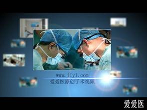 肛肠手术视频,肛肠手术操作步骤及要点解析